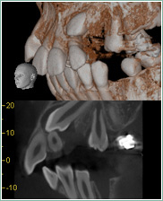スキャンされた2D・3Dの画像